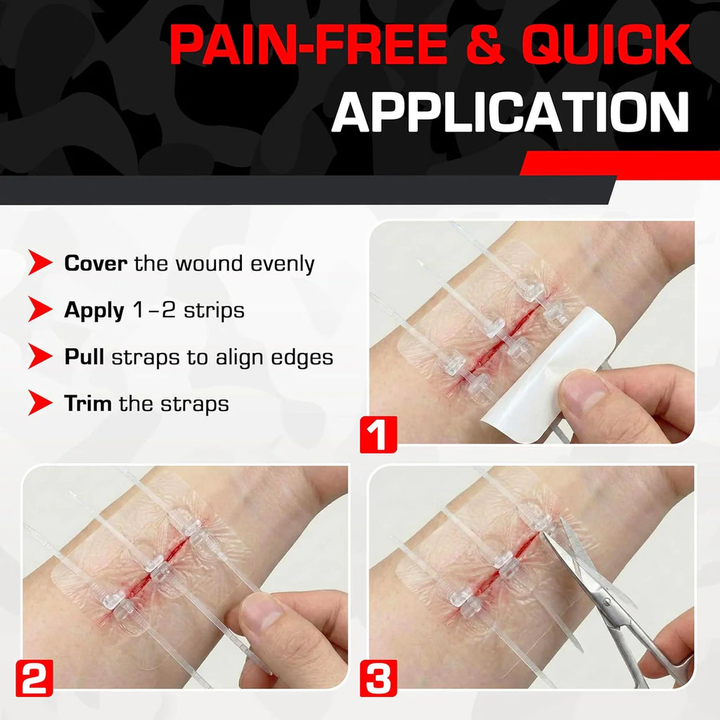 Medizip Stitchless Zip Wound Closure Strip 60×70mm